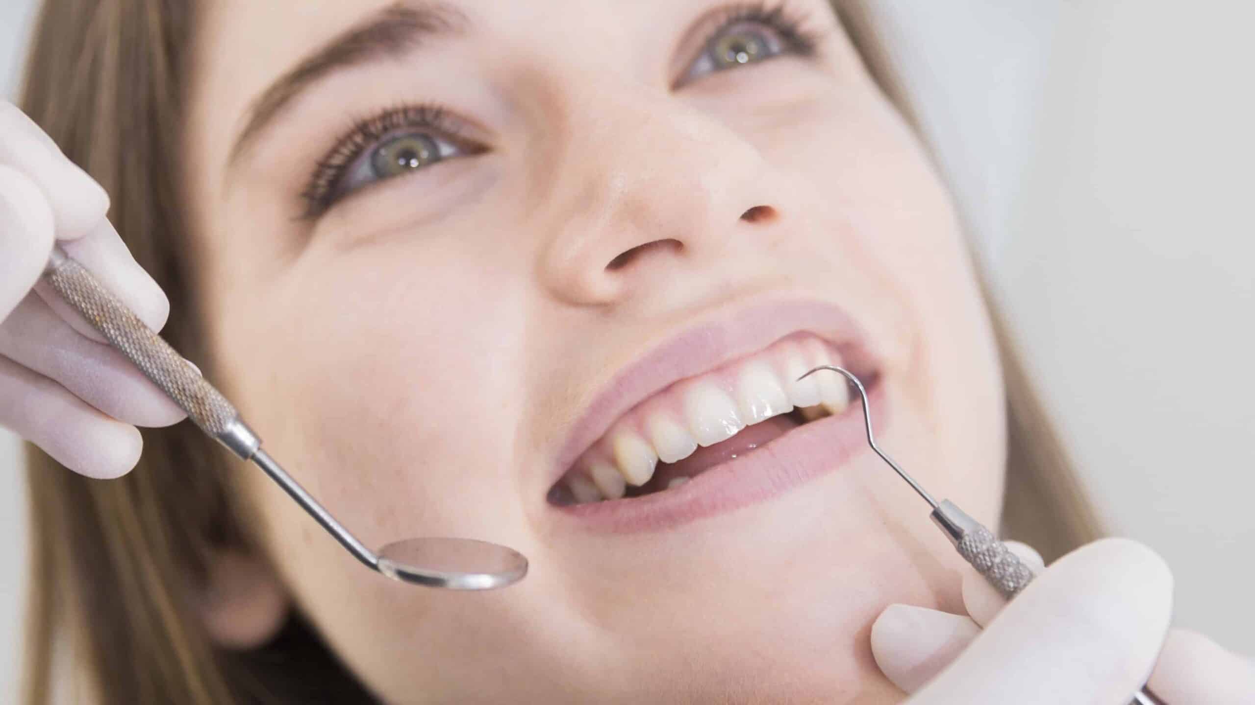 Dental Health Check Raynes Park - A Patient Is Shown Smiling During A Dental Examination At Beverley Dental In Raynes Park. The Dentist's Gloved Hands Are Gently Holding Dental Instruments, Including A Mirror And A Scaler, As They Carefully Inspect The Patient's Teeth. The Patient Looks Relaxed And Content, Reflecting The Professional And Comfortable Care Provided At Beverley Dental. This Image Highlights The Importance Of Regular Dental Health Checks And The Expertise Available At Beverley Dental To Ensure Optimal Oral Health For Their Patients.